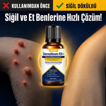 Timilk® DermaVenom RX+ - Siğil ve Et Beni Yağı
